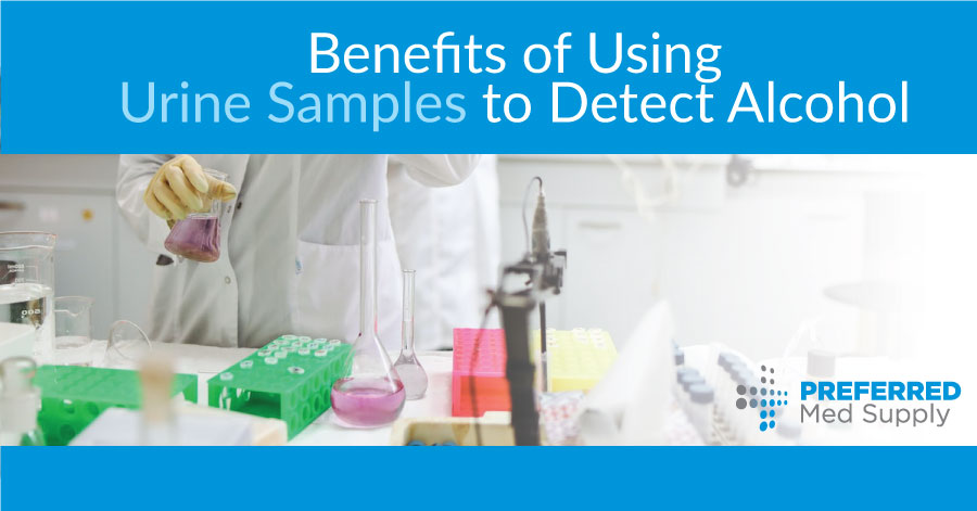 Benefits of Using a Urine Test for Alcohol