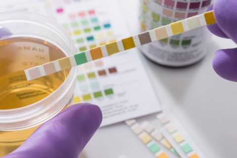 Drug Tests Employers Will Use