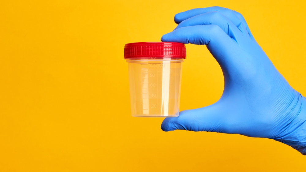 order drug test cup online